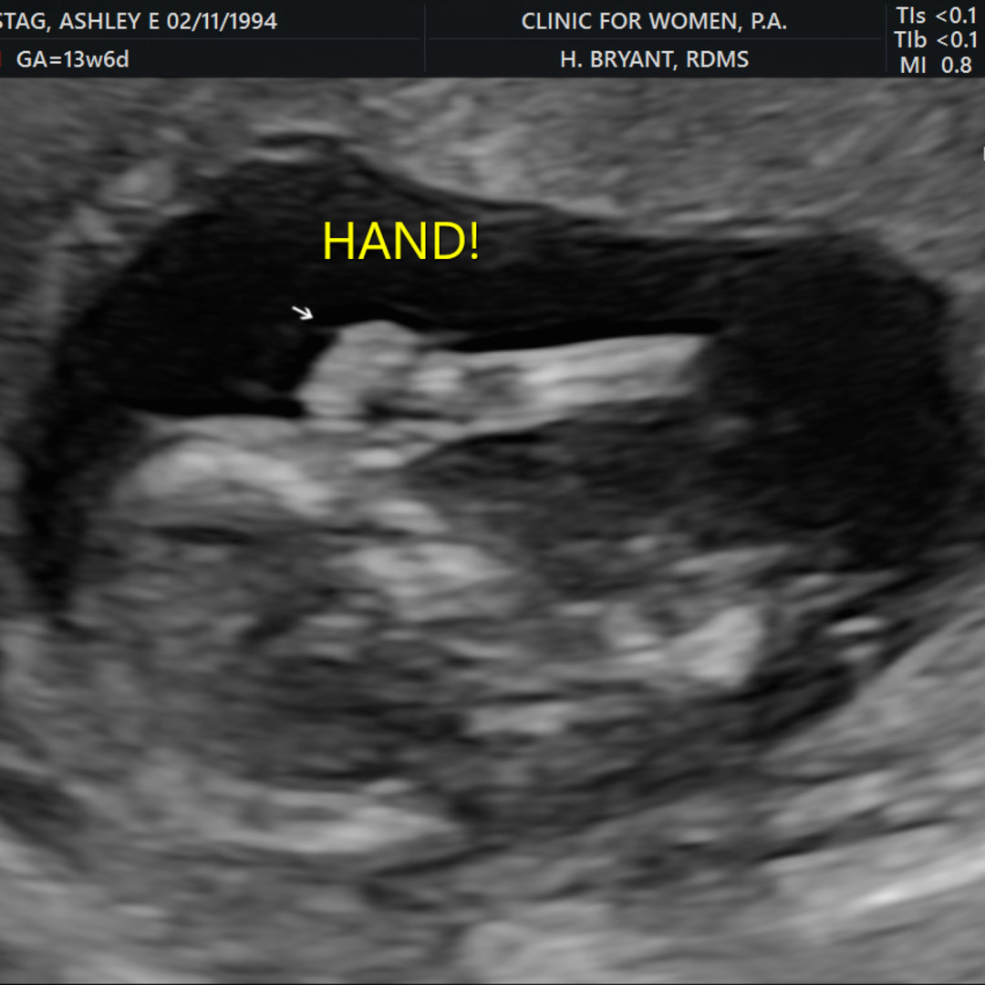 Photo shared by Ashley for their Babylist baby registry.