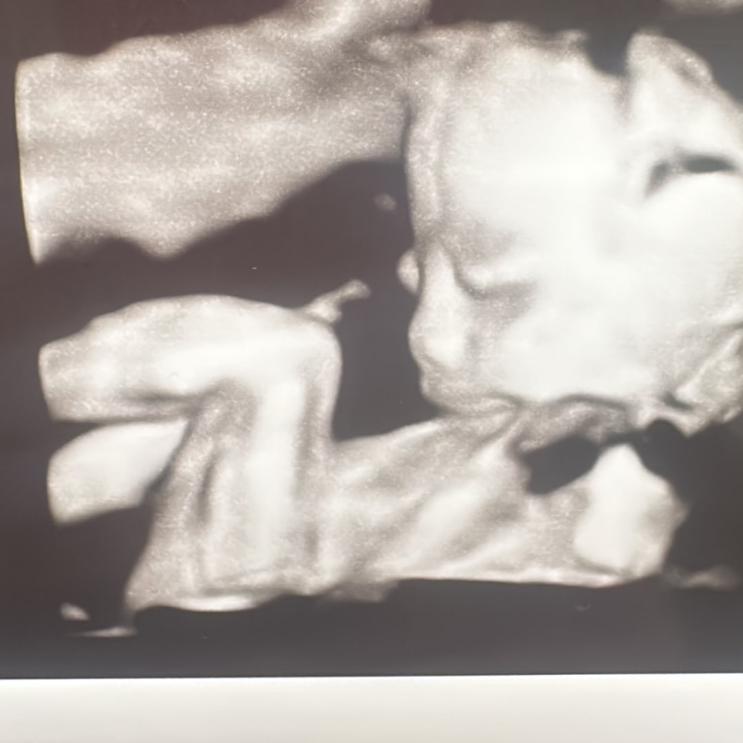 Photo shared by Georgie for their Babylist baby registry.