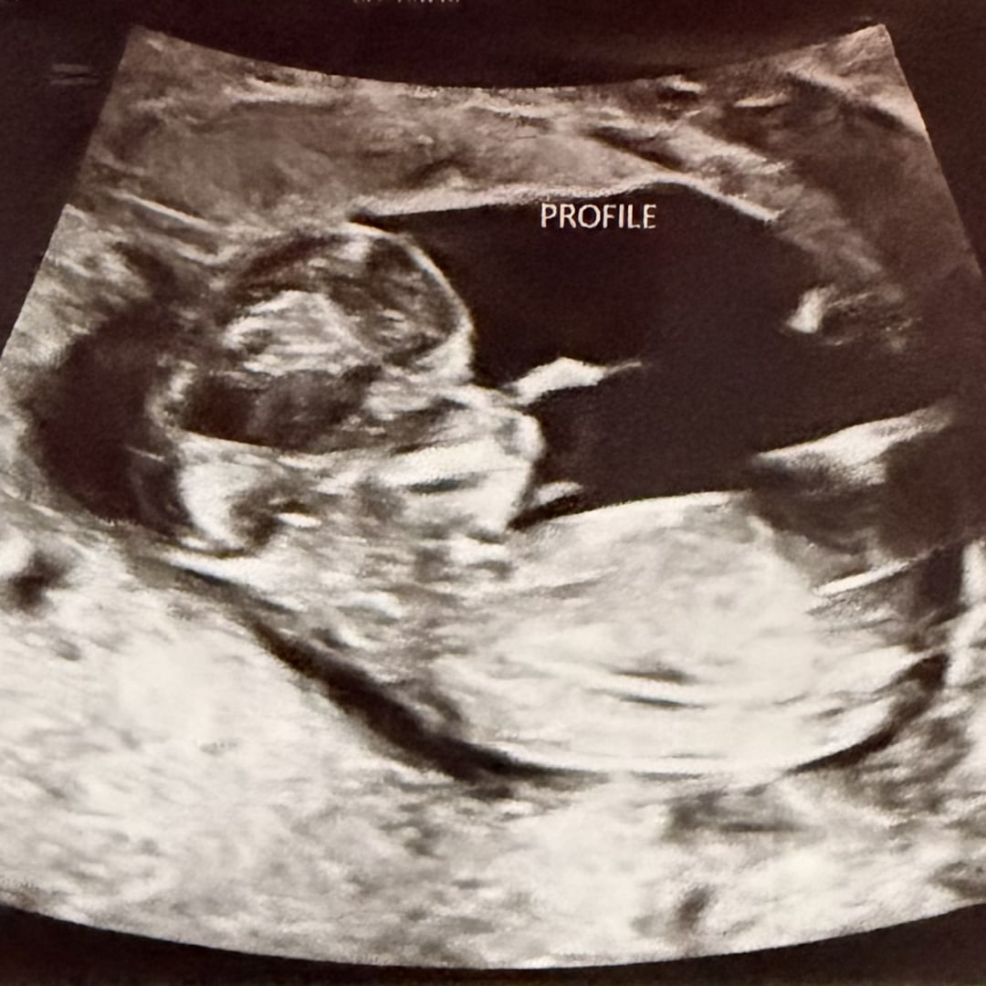 Photo shared by Diana for their Babylist baby registry.