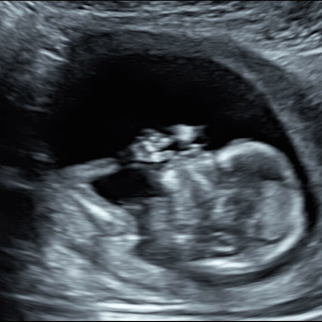 Photo shared by Bekah for their Babylist baby registry.