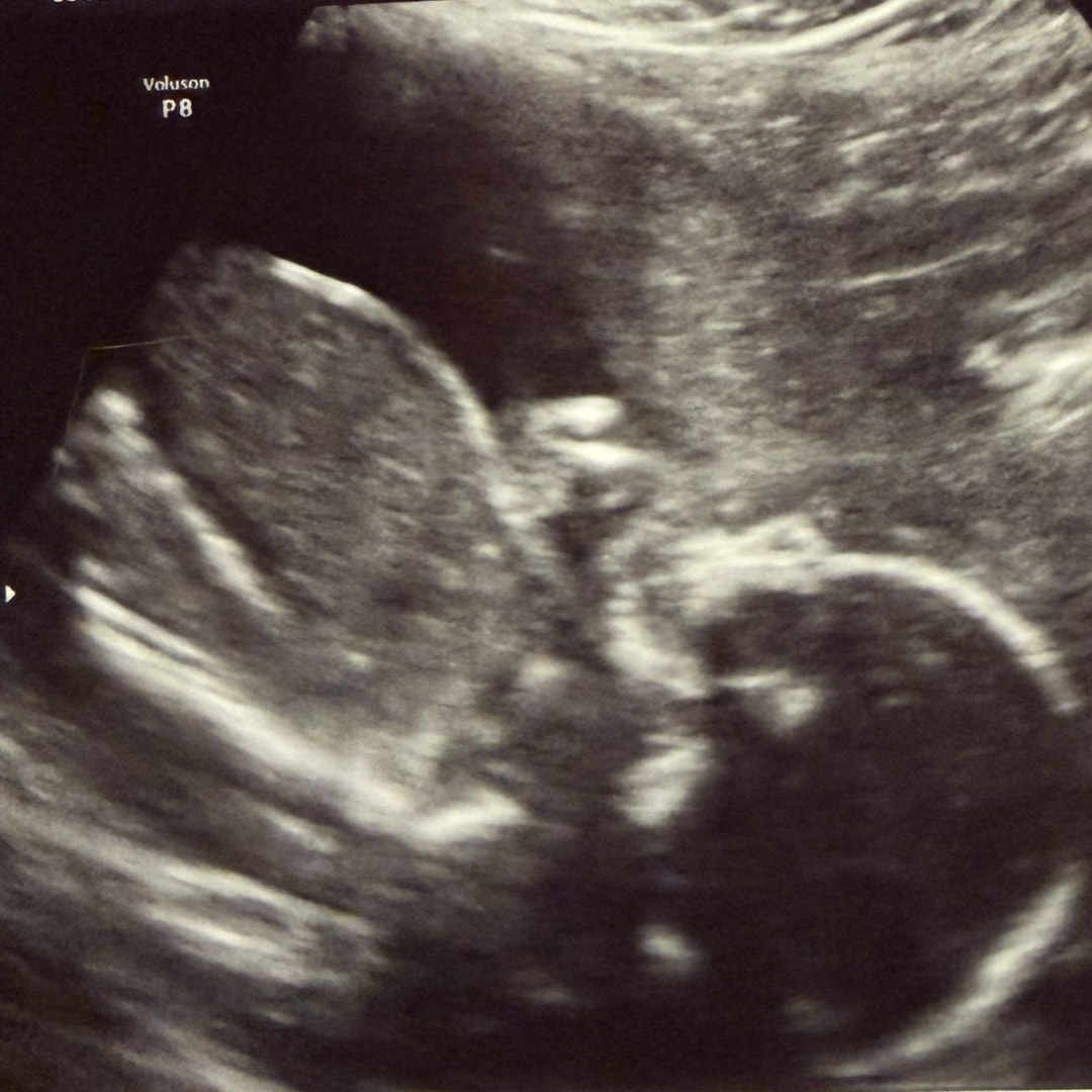 Photo shared by Gabrielle for their Babylist baby registry.