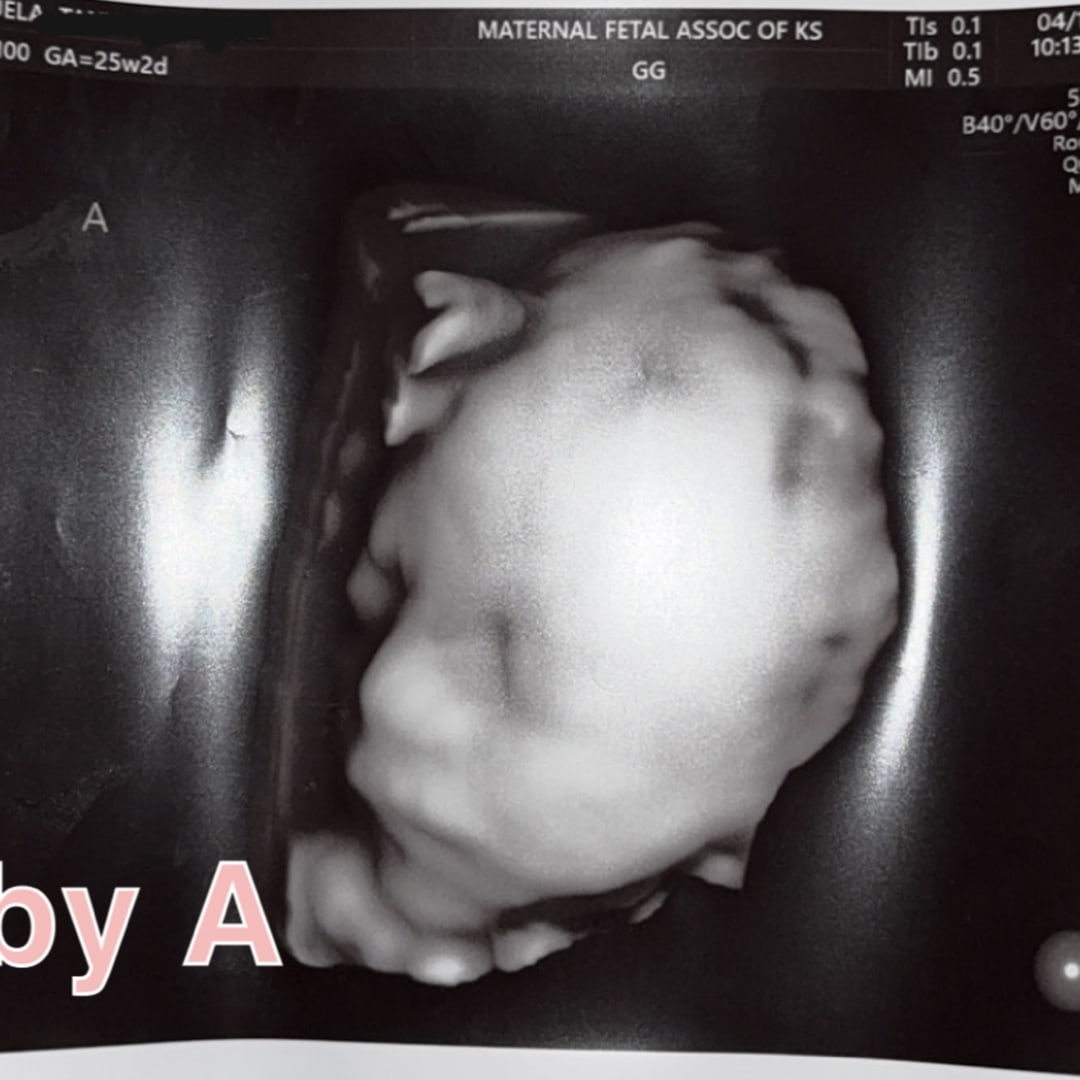 Photo shared by Tanya for their Babylist baby registry.
