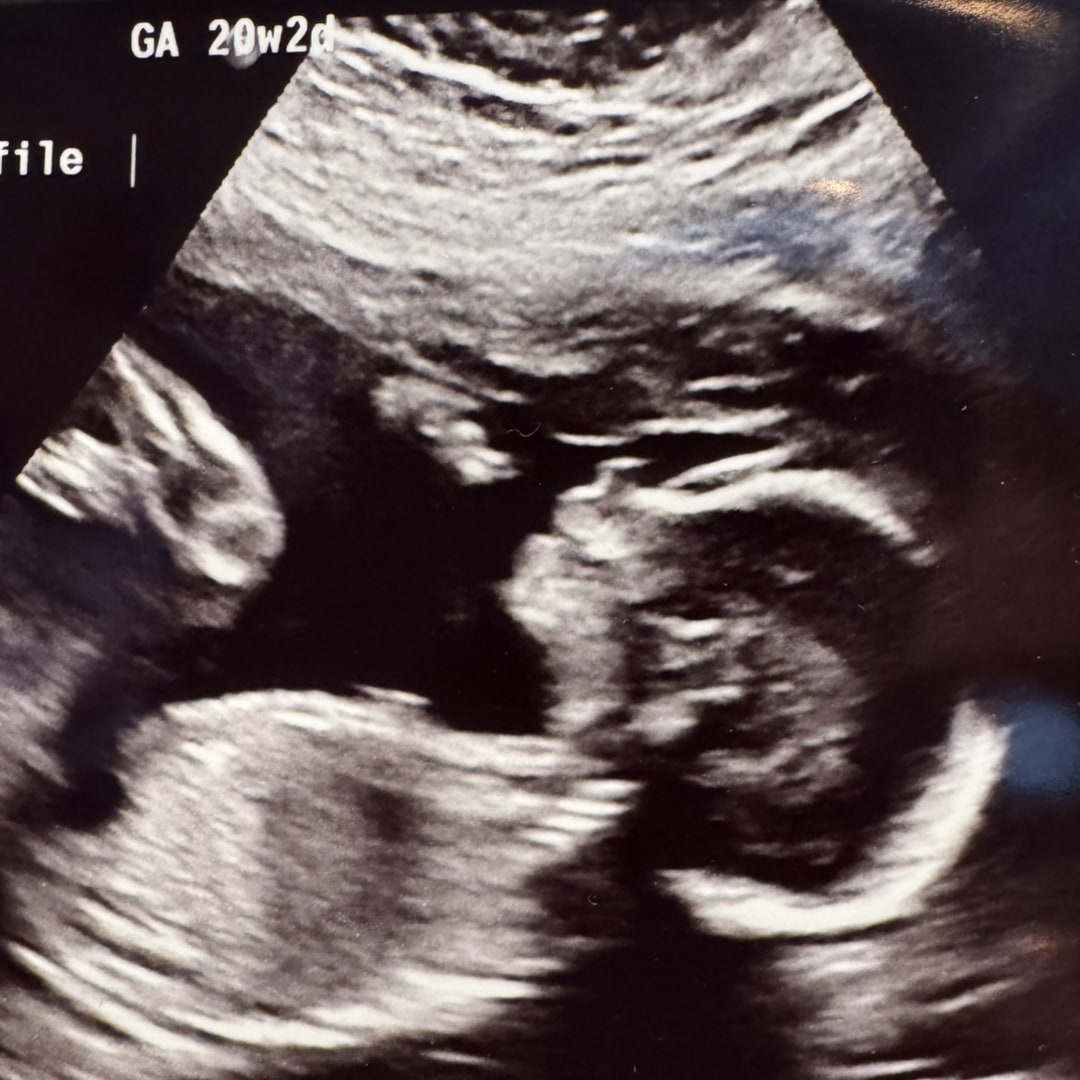 Photo shared by Tara for their Babylist baby registry.