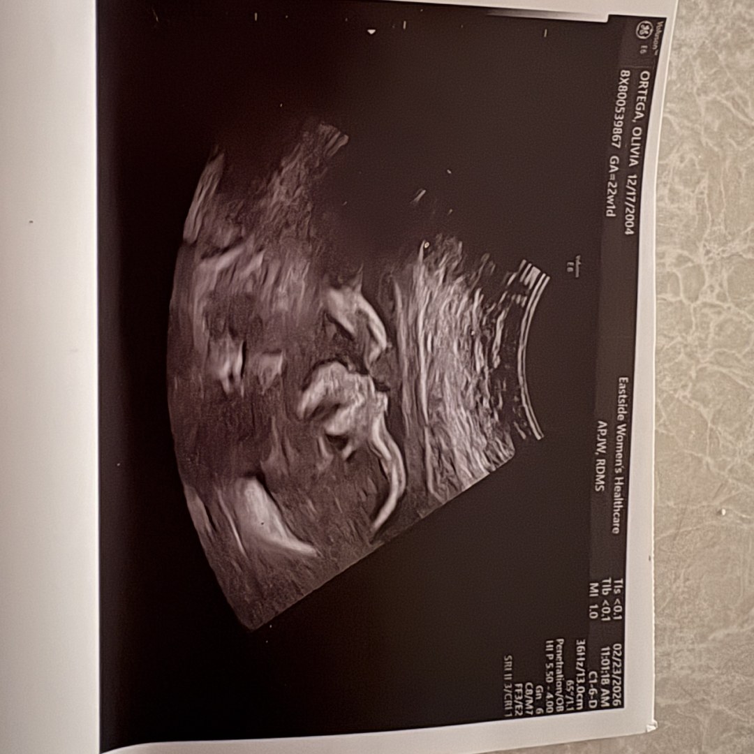 Photo shared by Olivia for their Babylist baby registry.