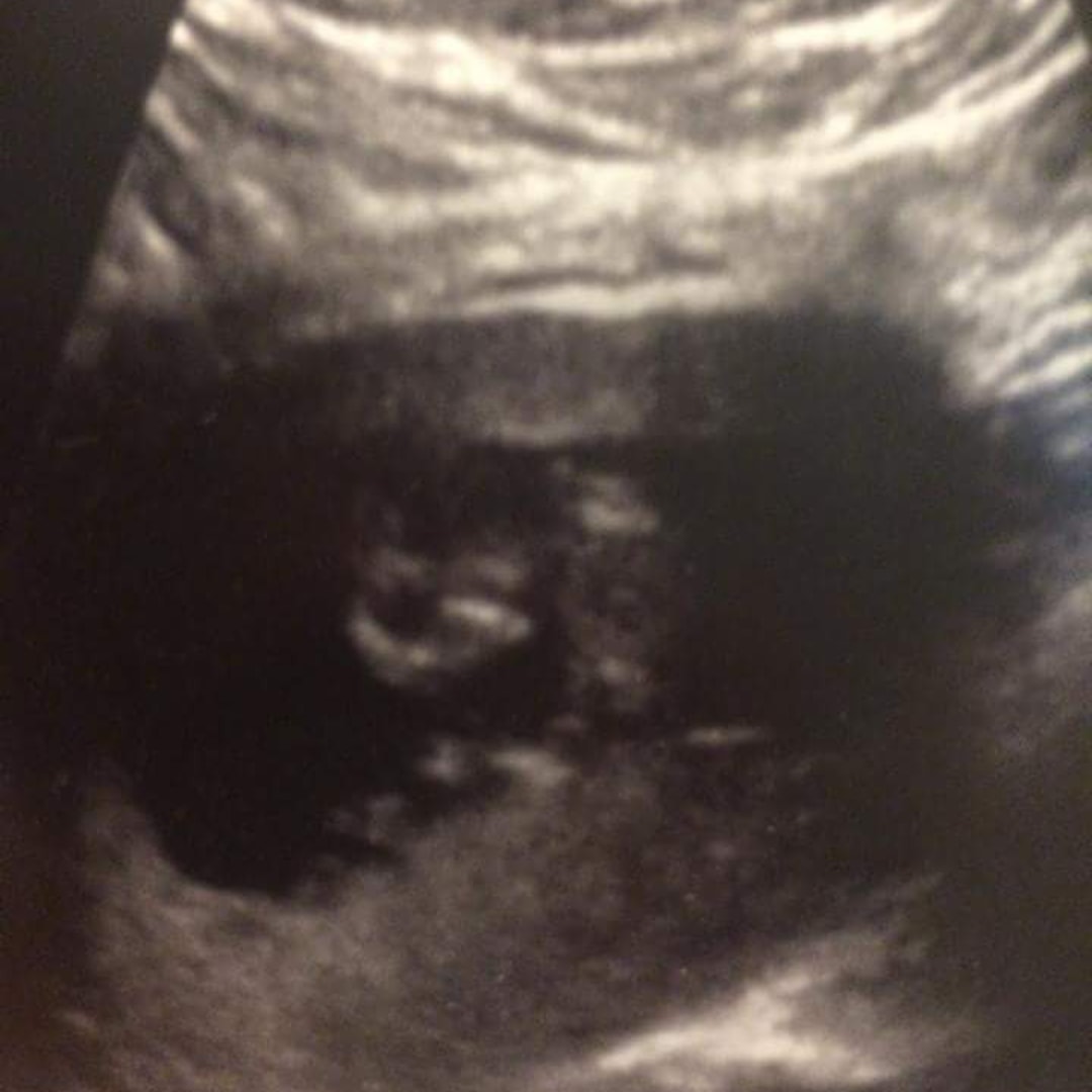 Photo shared by Beverly for their Babylist baby registry.