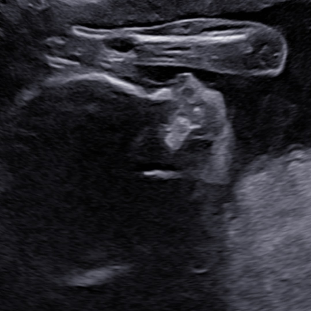 Photo shared by Autumn for their Babylist baby registry.