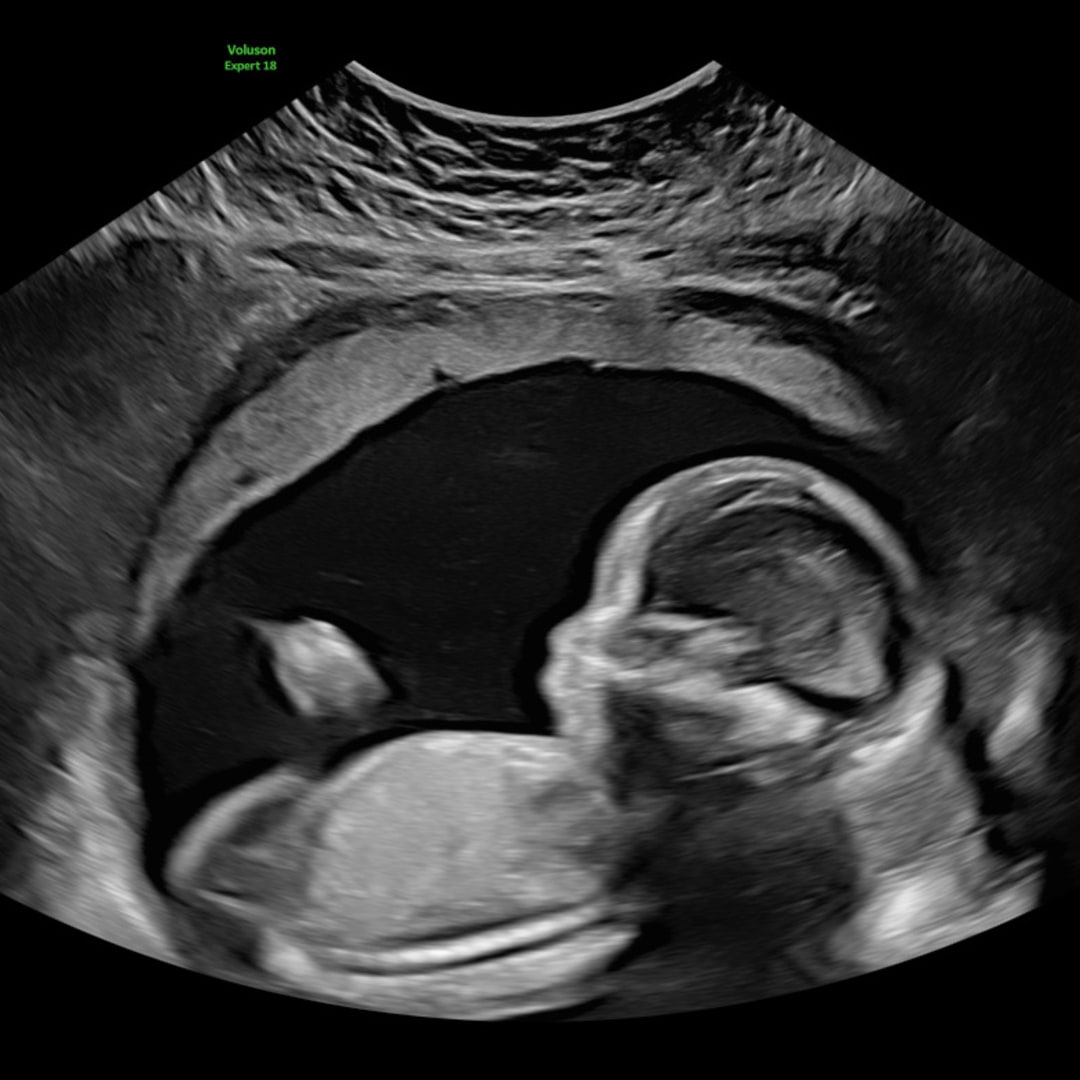 Photo shared by Caitlin for their Babylist baby registry.