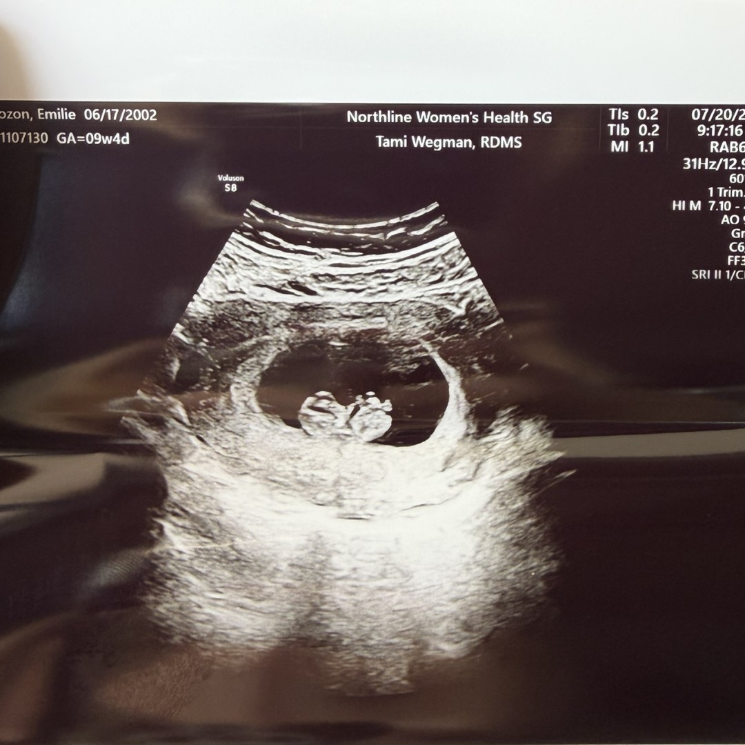 Photo shared by Emilie for their Babylist baby registry.