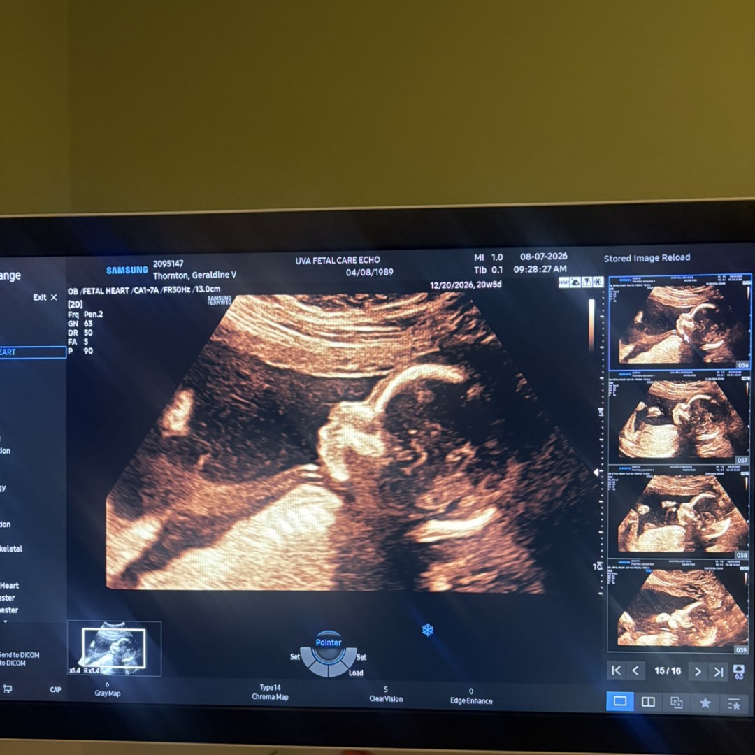 Photo shared by Geraldine for their Babylist baby registry.