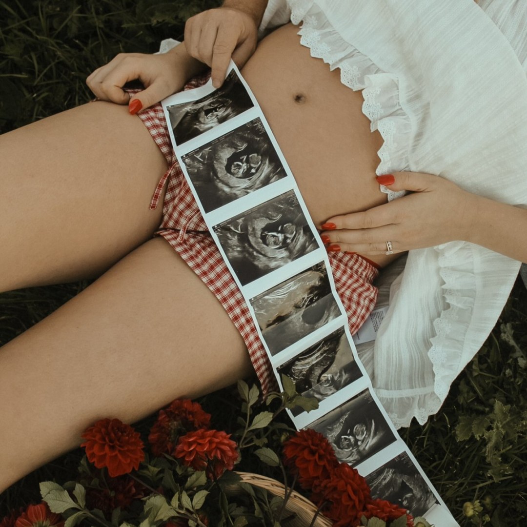 Photo shared by Callie for their Babylist baby registry.