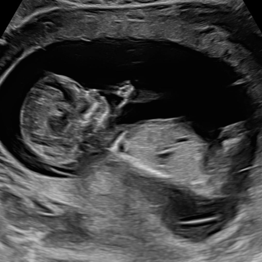 Photo shared by Josie for their Babylist baby registry.