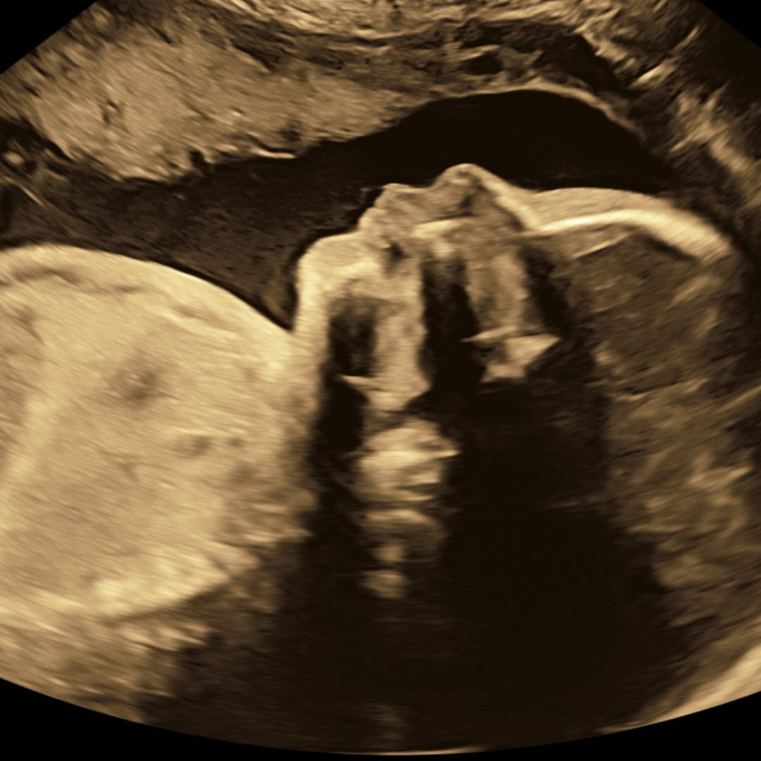 Photo shared by Catherine for their Babylist baby registry.