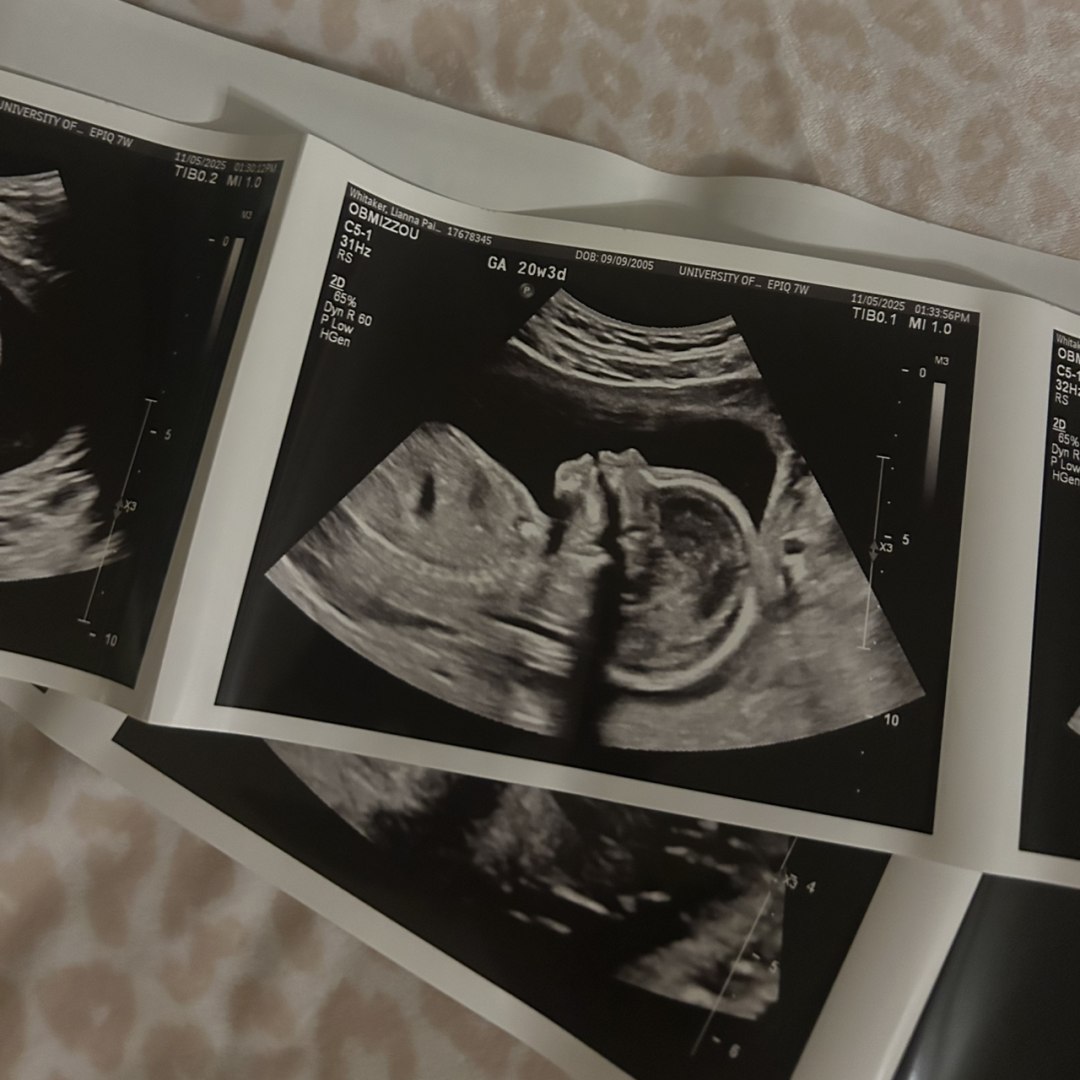 Photo shared by Lianna for their Babylist baby registry.