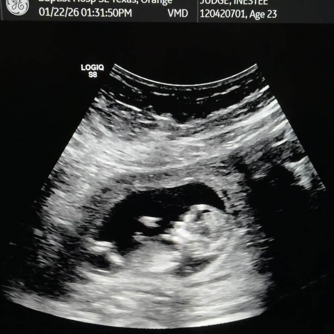 Photo shared by Inestee for their Babylist baby registry.