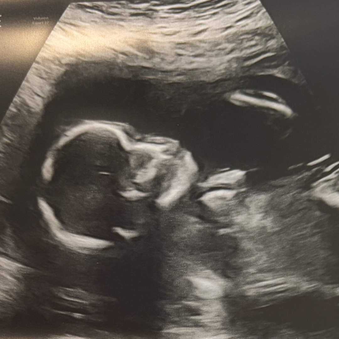 Photo shared by Patty for their Babylist baby registry.