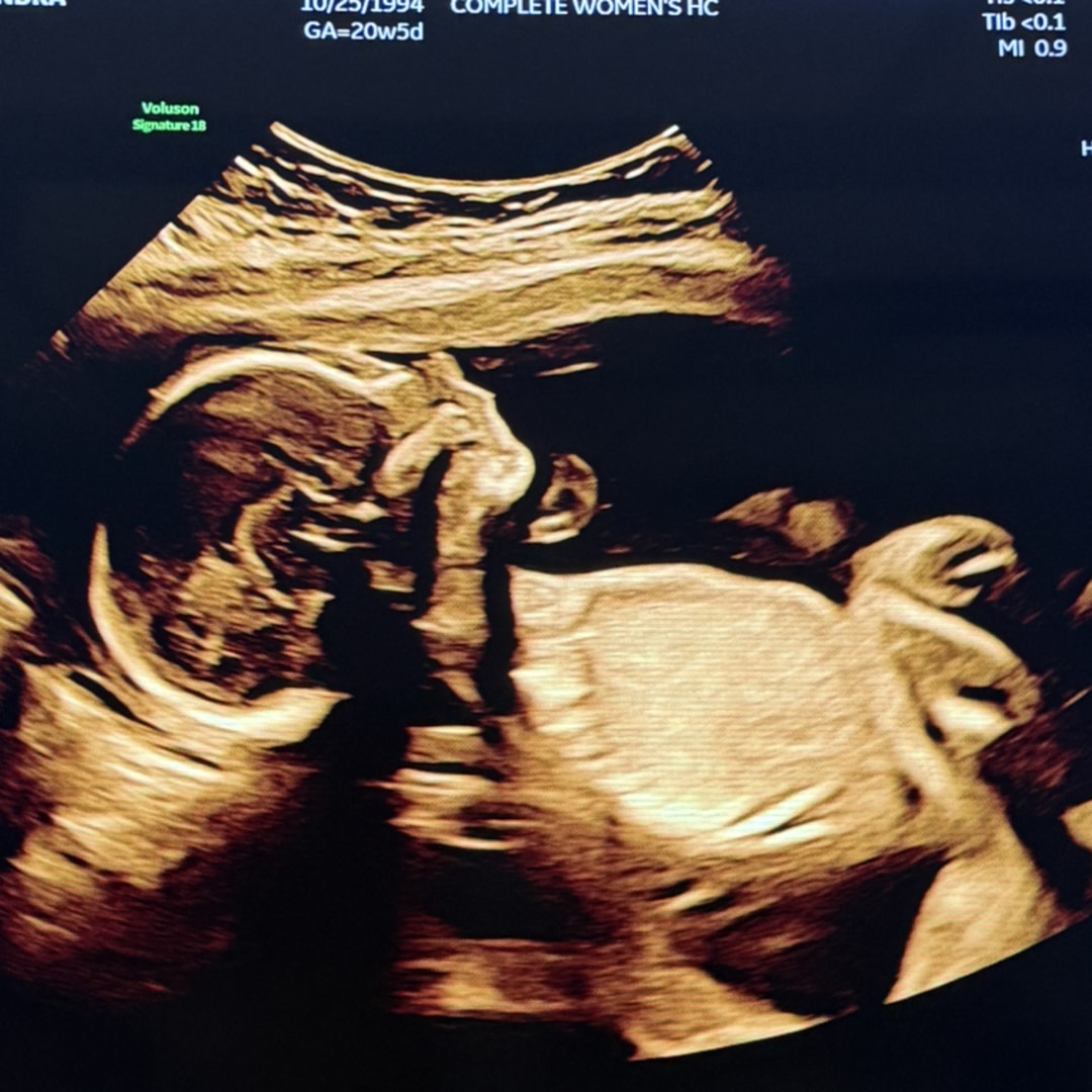 Photo shared by Sandra for their Babylist baby registry.