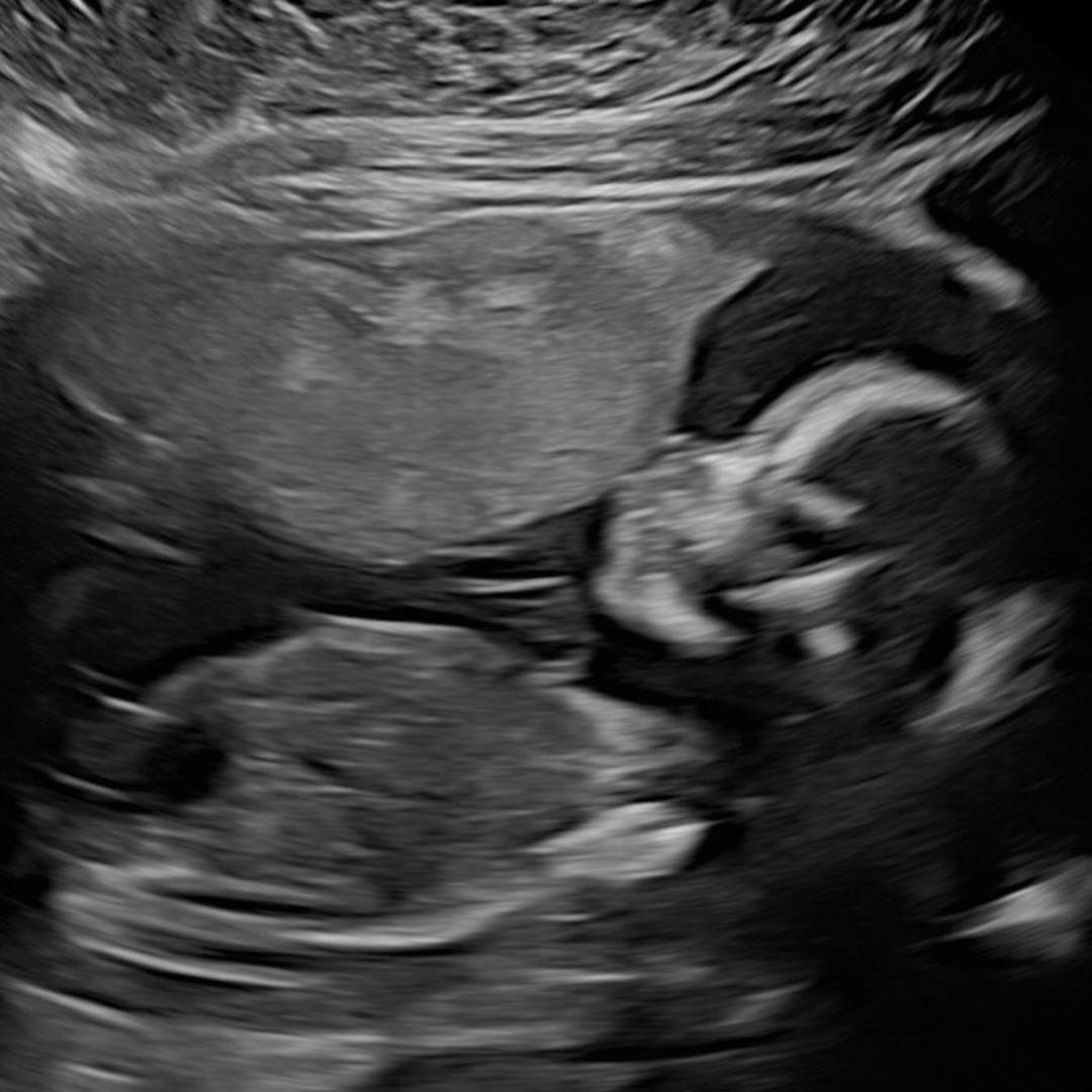 Photo shared by Heidi for their Babylist baby registry.
