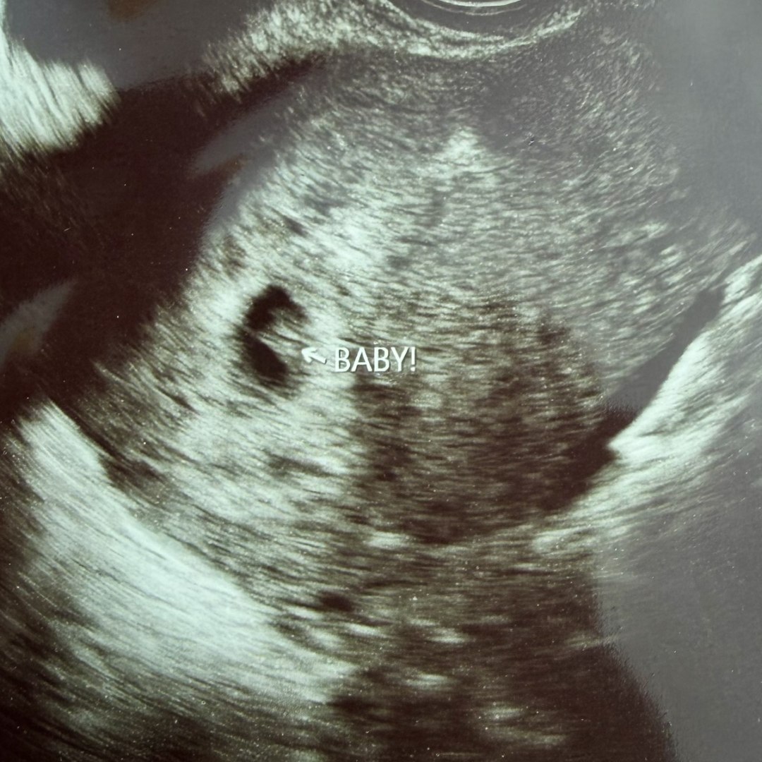 Photo shared by Brianna for their Babylist baby registry.