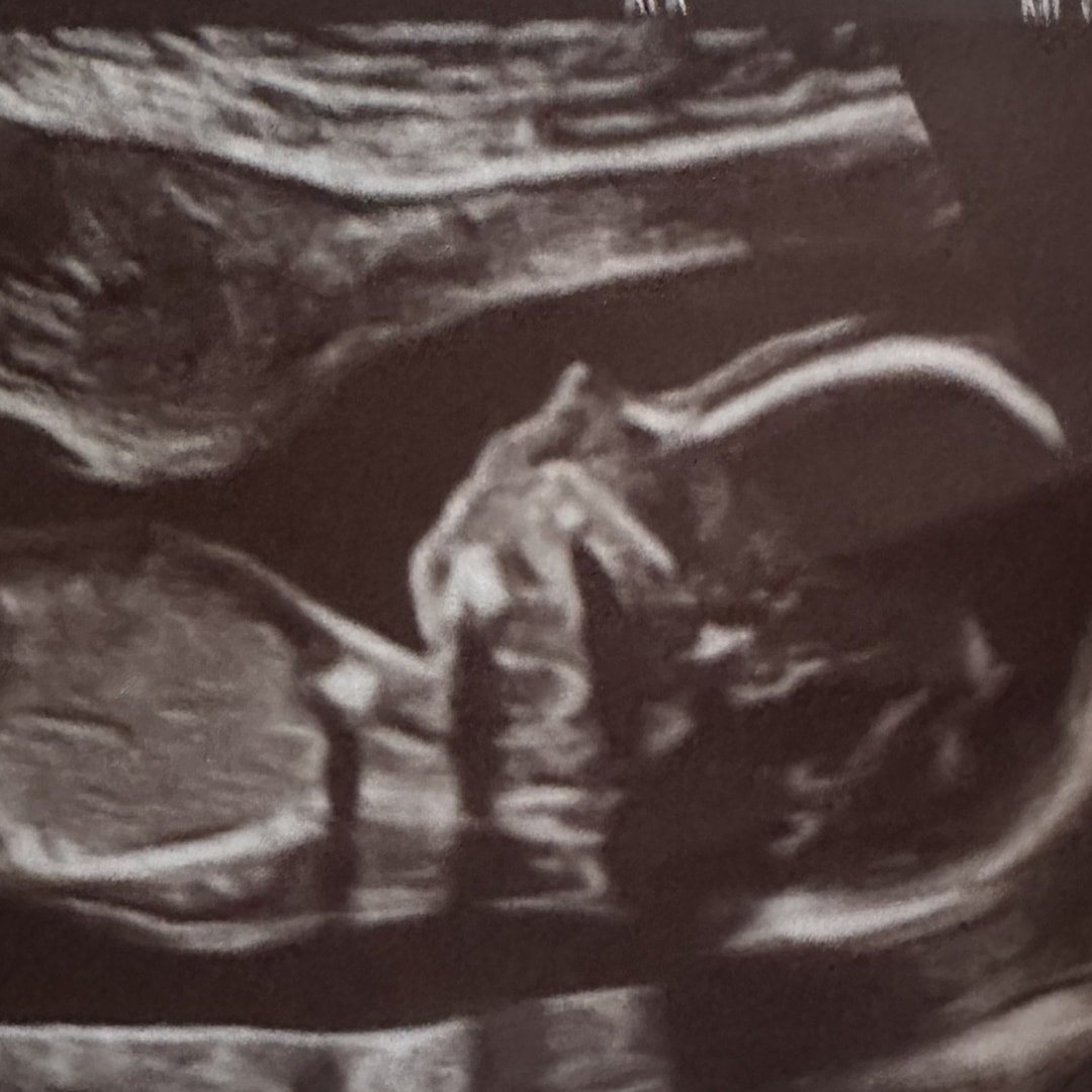 Photo shared by Shanika for their Babylist baby registry.