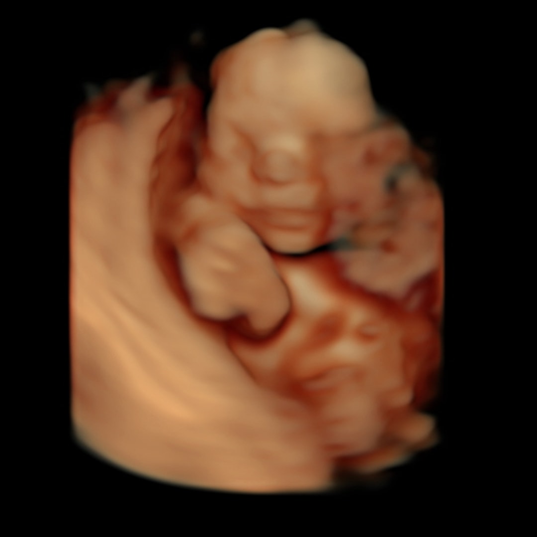 Photo shared by Brooke for their Babylist baby registry.