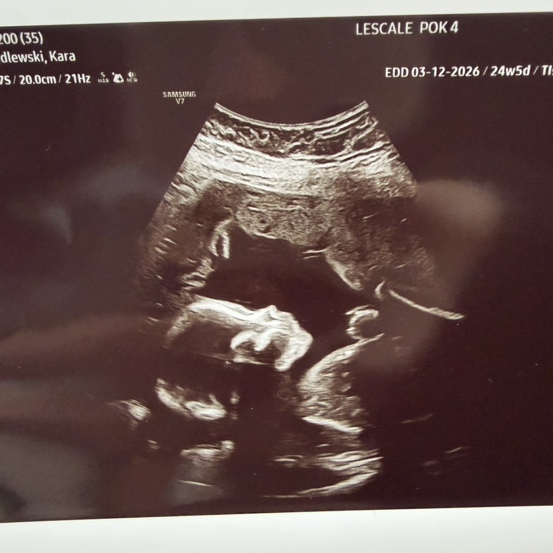 Photo shared by Kara for their Babylist baby registry.