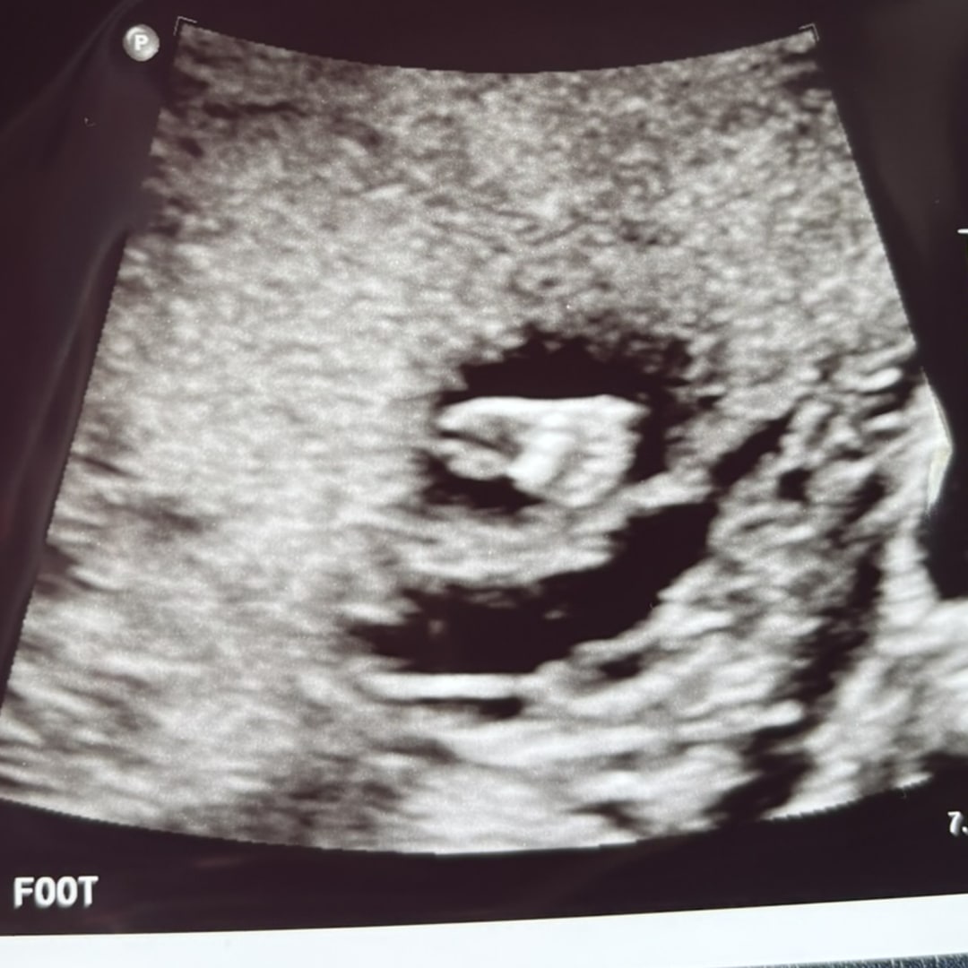 Photo shared by Emma for their Babylist baby registry.