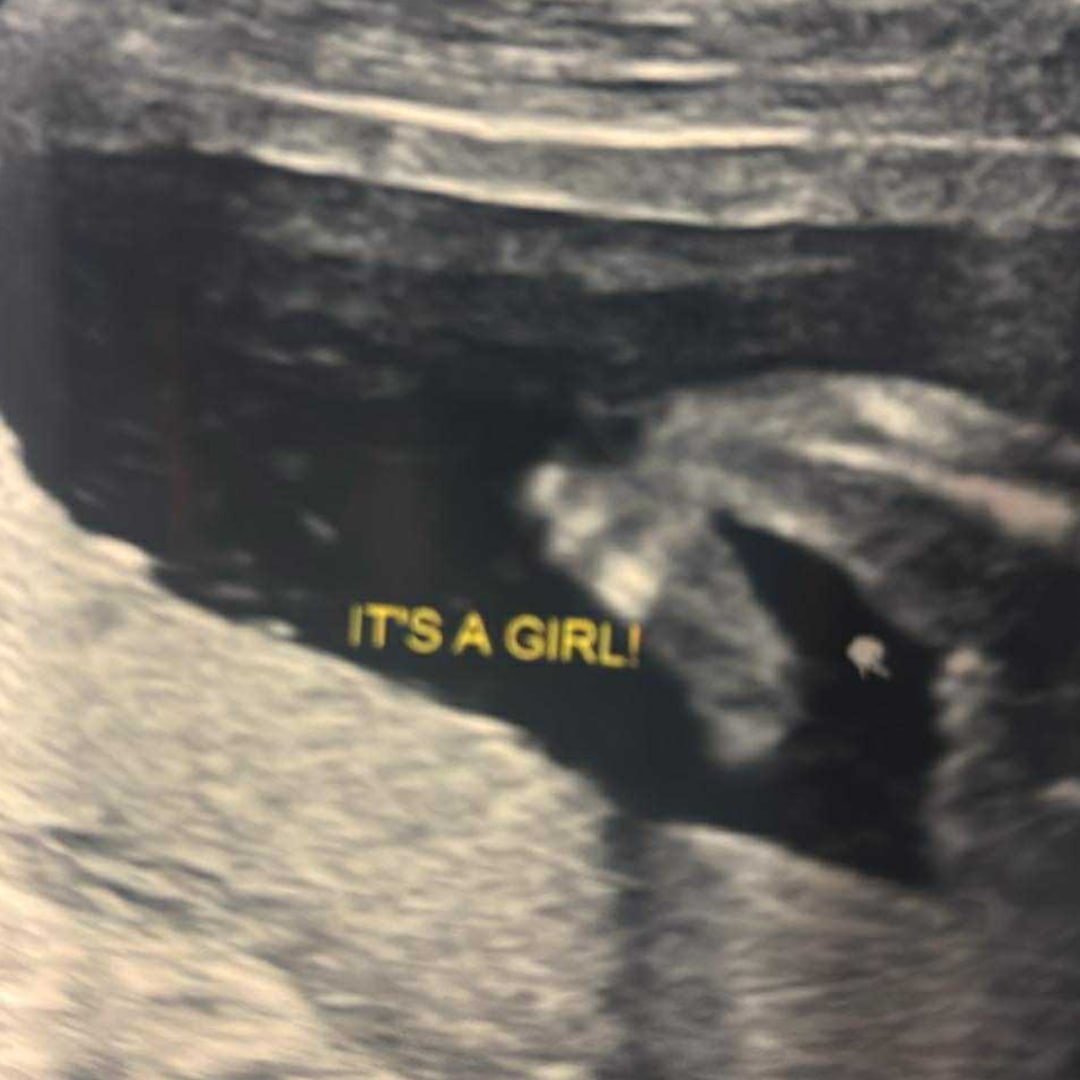 Photo shared by Natalie for their Babylist baby registry.