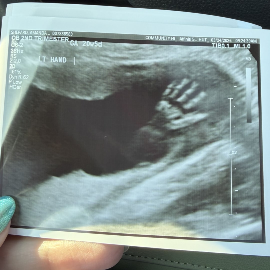 Photo shared by Amanda for their Babylist baby registry.