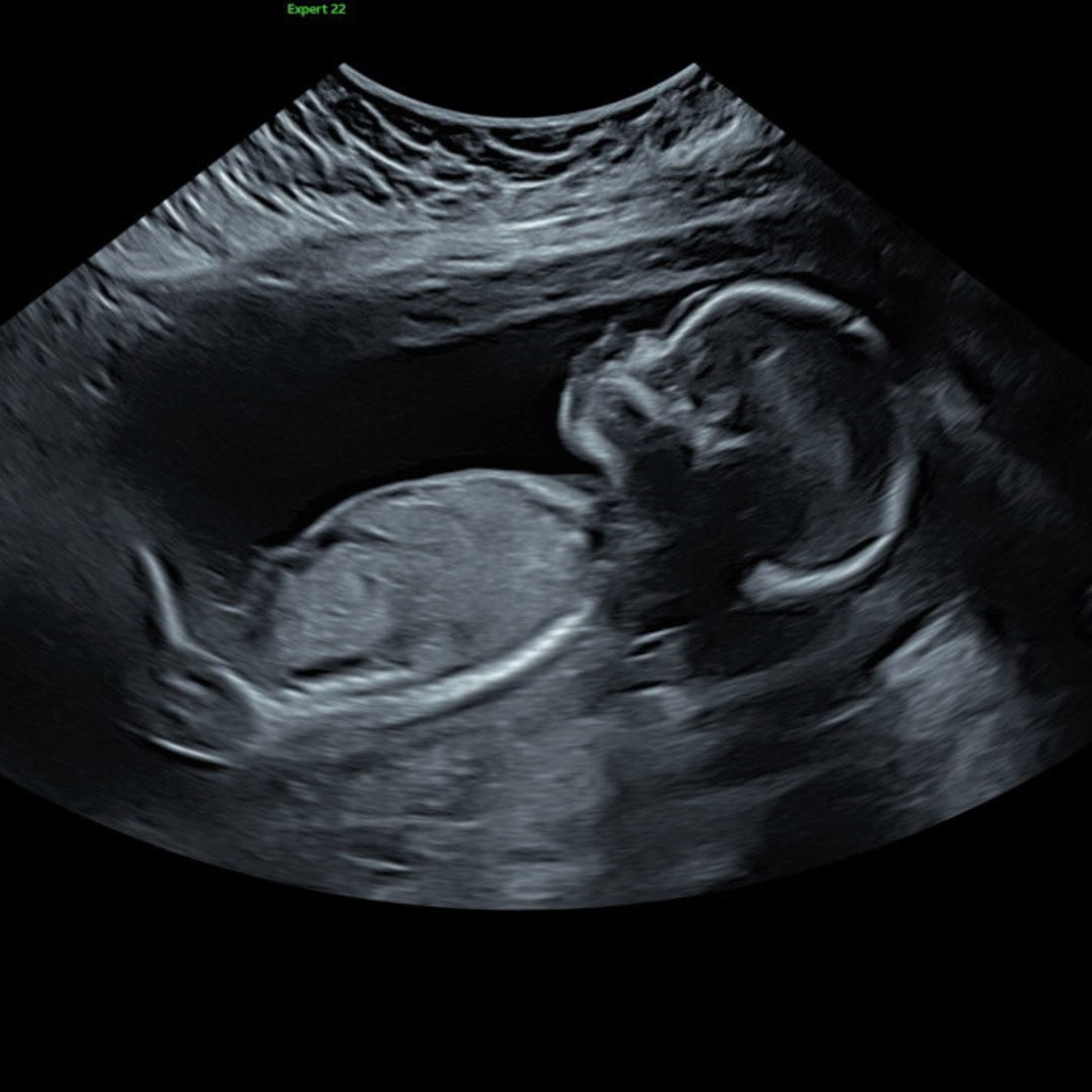 Photo shared by Bre for their Babylist baby registry.