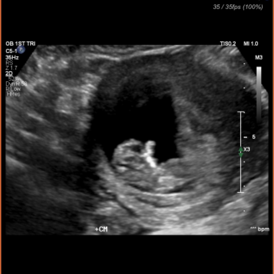 Photo shared by Dayna for their Babylist baby registry.