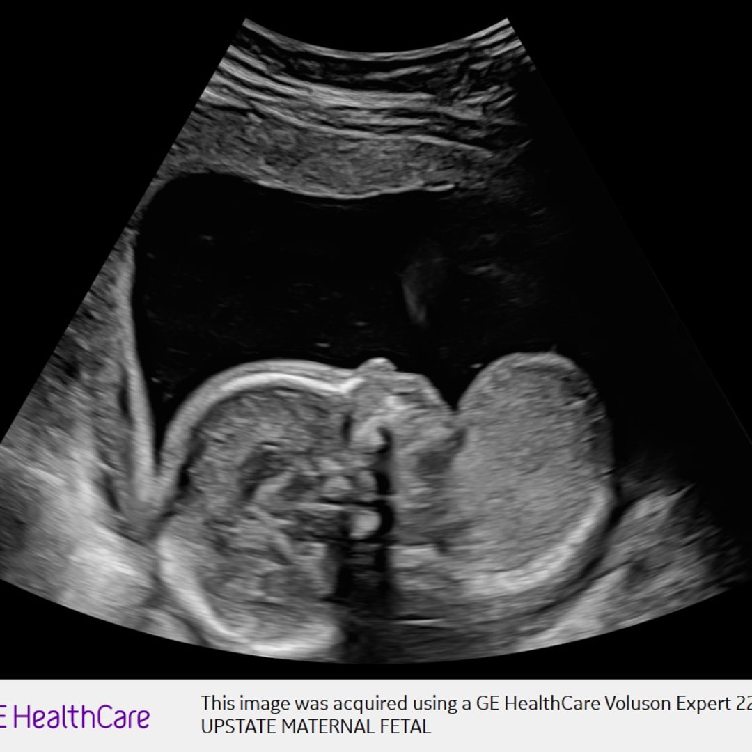 Photo shared by Promise for their Babylist baby registry.