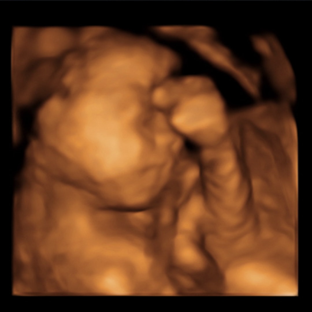 Photo shared by Ally for their Babylist baby registry.