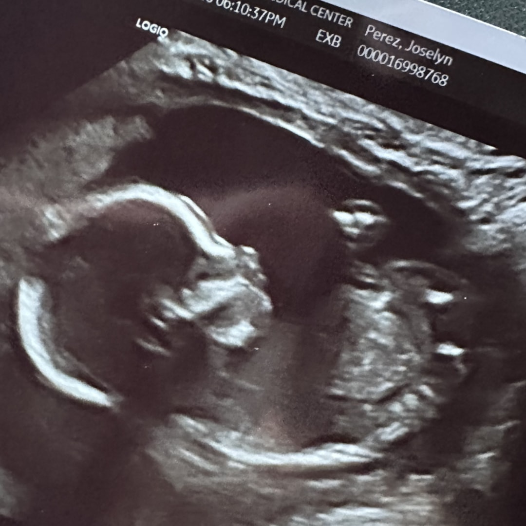 Photo shared by Joselyn for their Babylist baby registry.