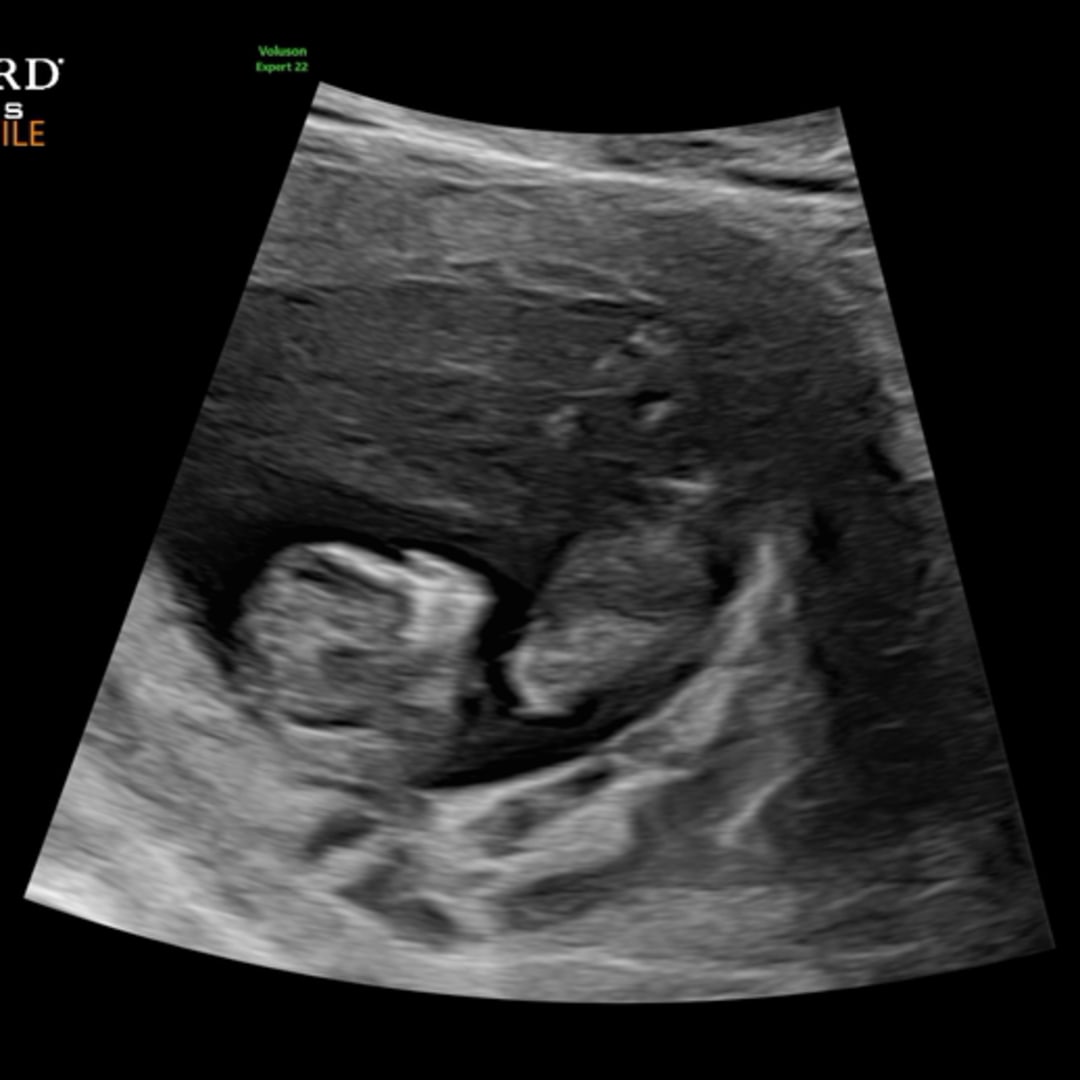 Photo shared by Draven for their Babylist baby registry.