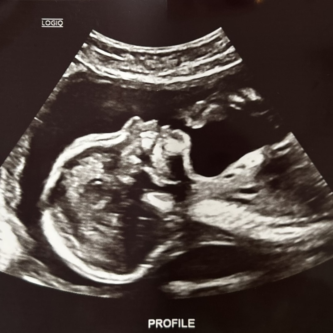 Photo shared by Andrea for their Babylist baby registry.