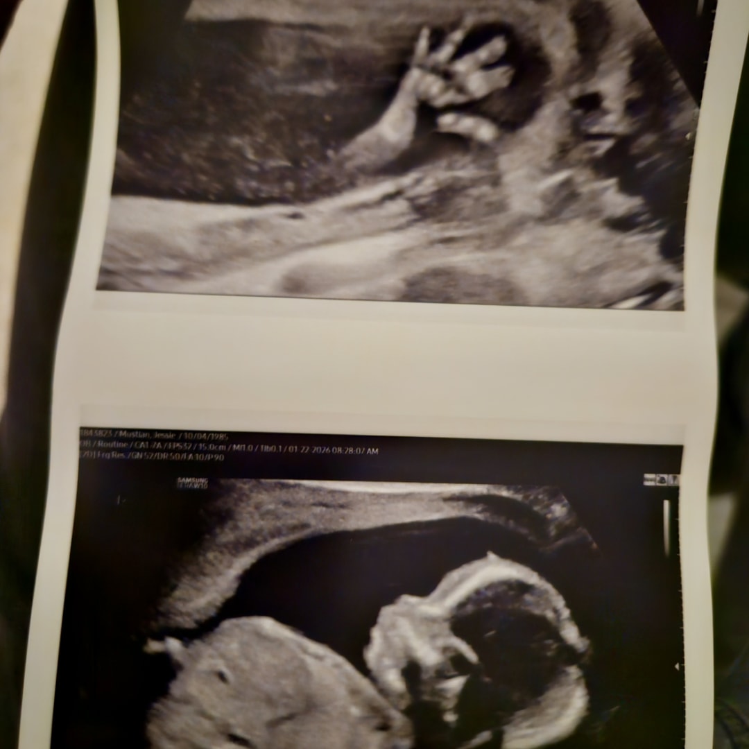 Photo shared by Peter for their Babylist baby registry.