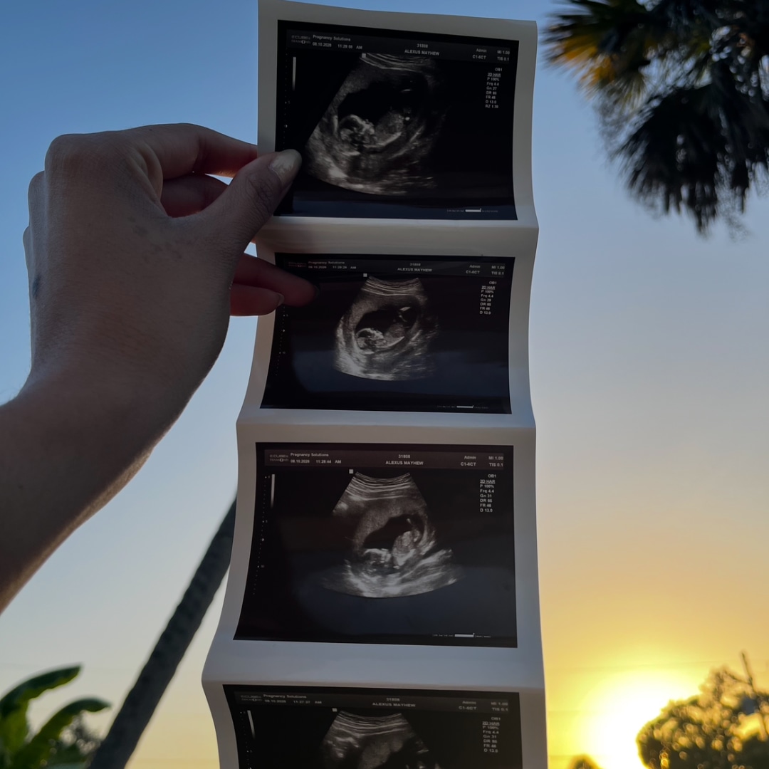 Photo shared by Alexus for their Babylist baby registry.