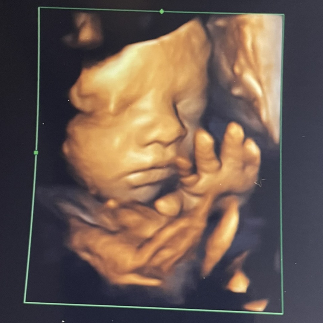 Photo shared by Lily for their Babylist baby registry.