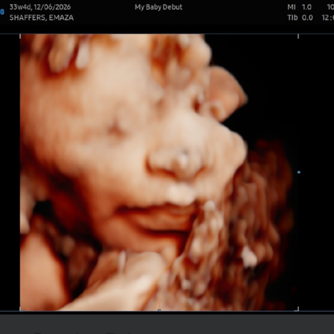 Photo shared by Emaza for their Babylist baby registry.