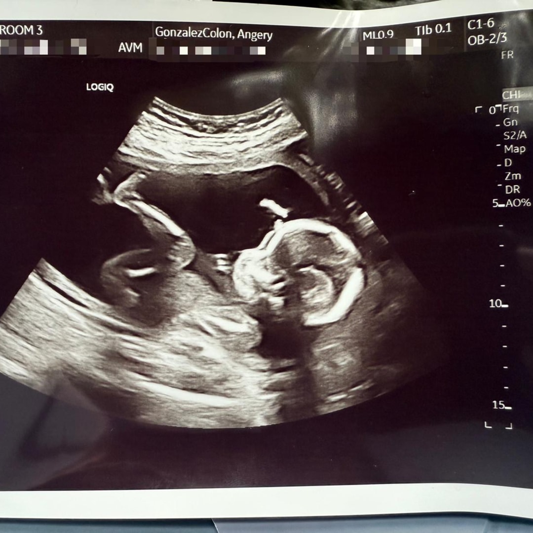 Photo shared by Angery M for their Babylist baby registry.