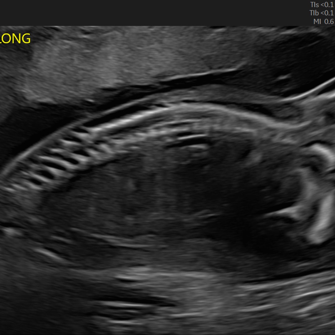 Photo shared by Ash for their Babylist baby registry.