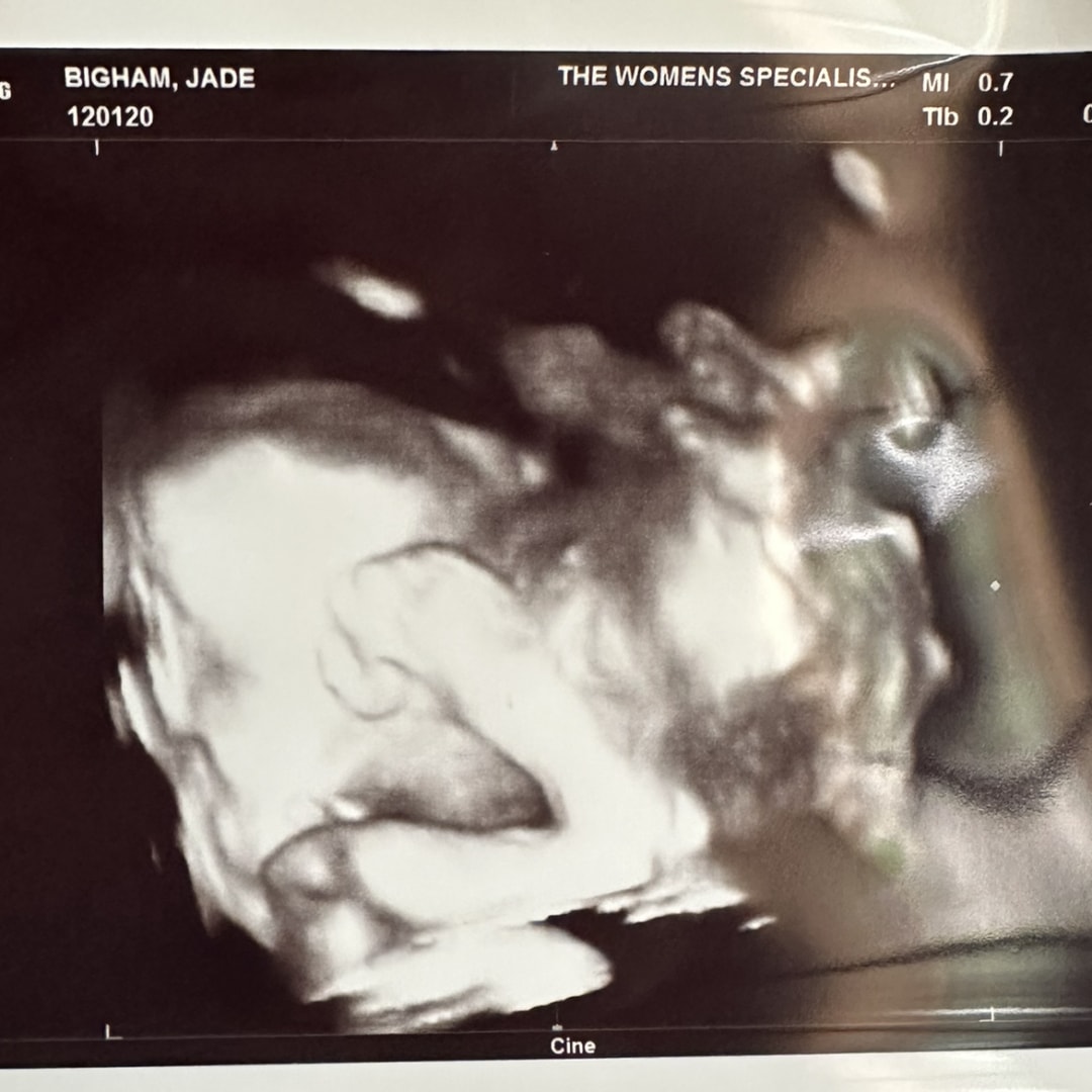 Photo shared by Jade for their Babylist baby registry.