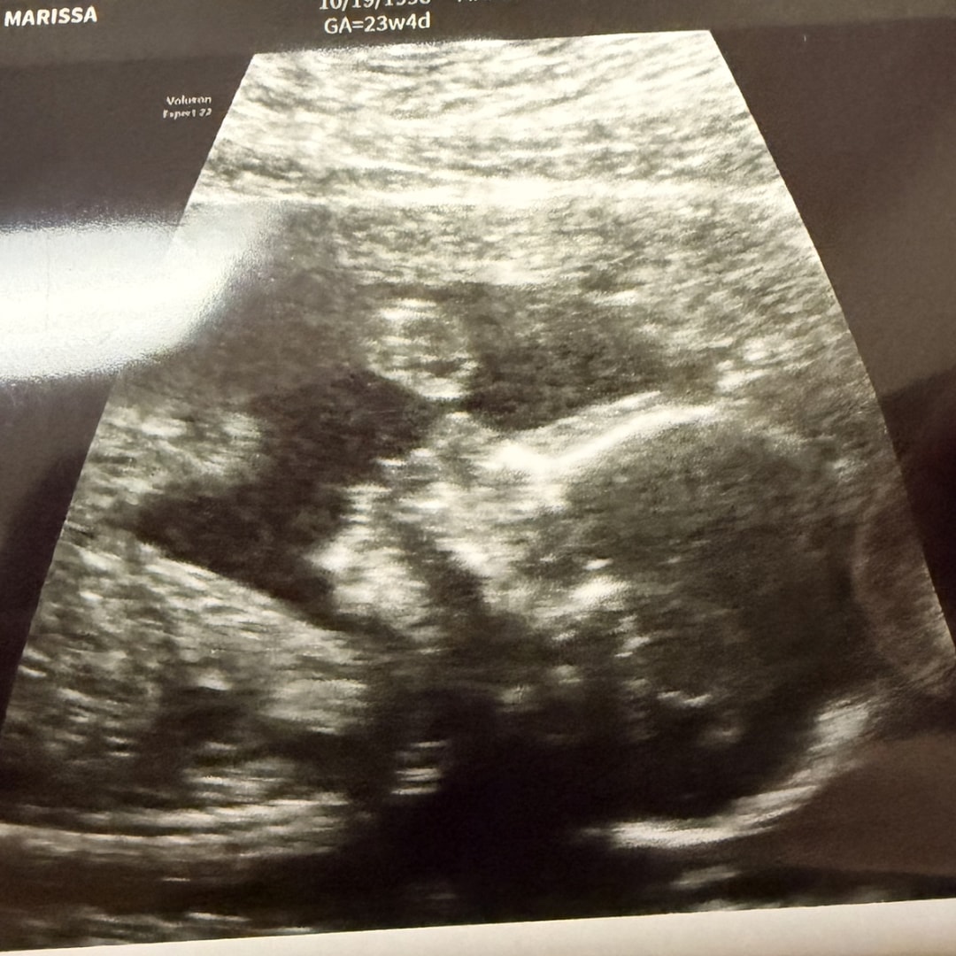 Photo shared by Marissa for their Babylist baby registry.