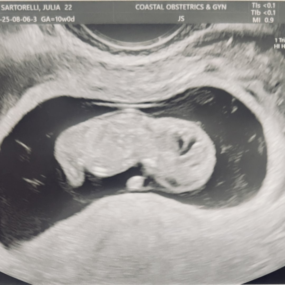 Photo shared by JULIA for their Babylist baby registry.