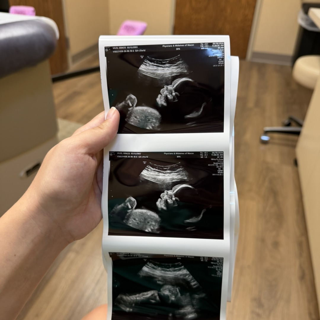 Photo shared by Gracie for their Babylist baby registry.