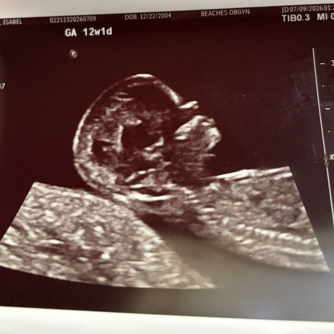 Photo shared by Isabel for their Babylist baby registry.