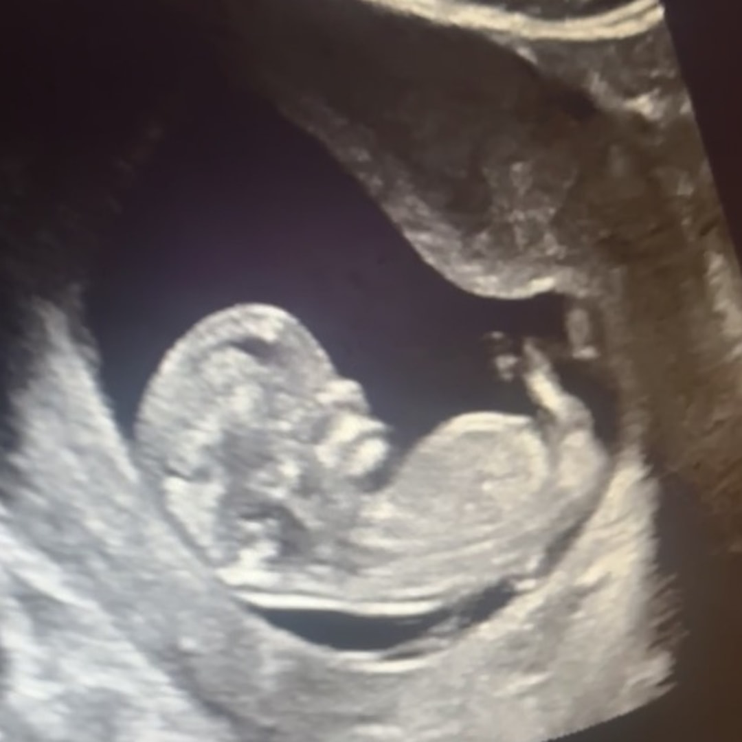 Photo shared by Erica for their Babylist baby registry.