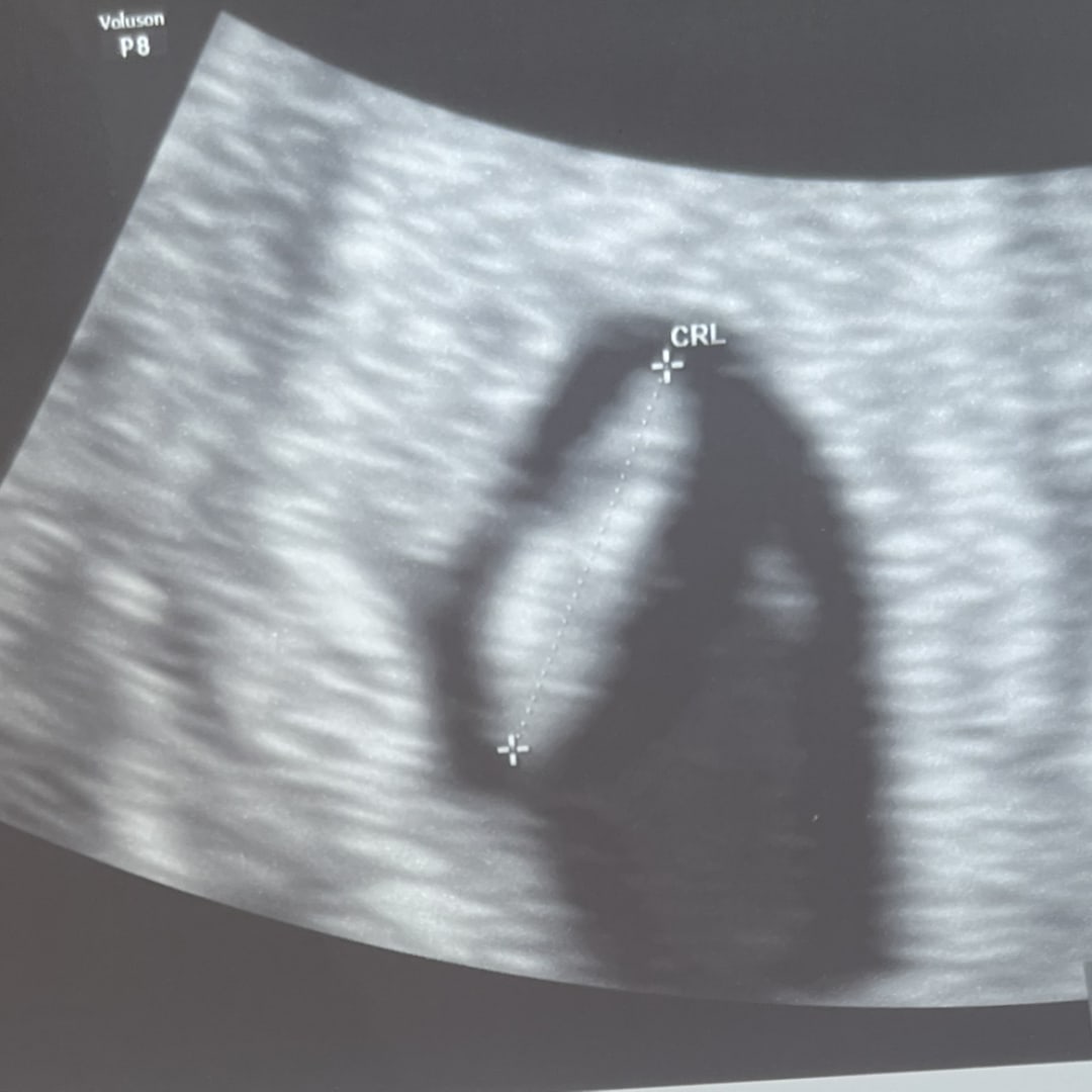 Photo shared by Carla for their Babylist baby registry.