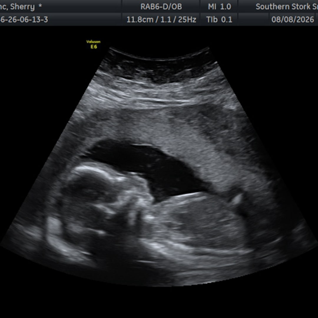 Photo shared by Sherry for their Babylist baby registry.
