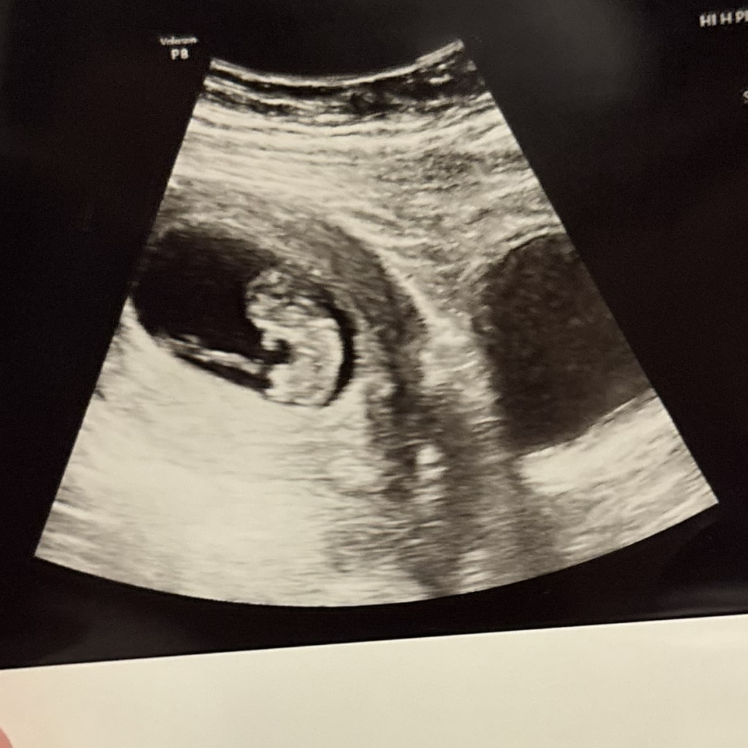 Photo shared by Victoria for their Babylist baby registry.